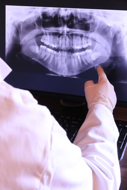 Emergency Dental Filling Replacement in FL